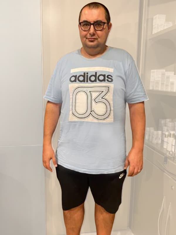 Geral Xuereb before transformation