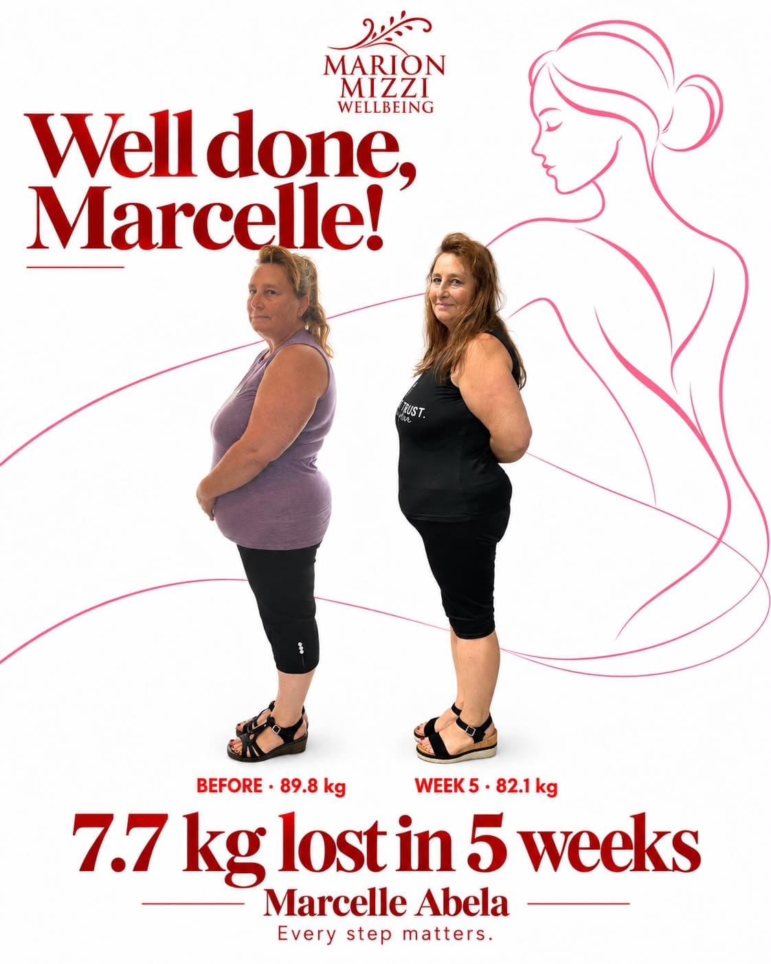 Marcelle Abela before and after the Anti-Obesity Programme: 7.7 kg lost in 5 weeks