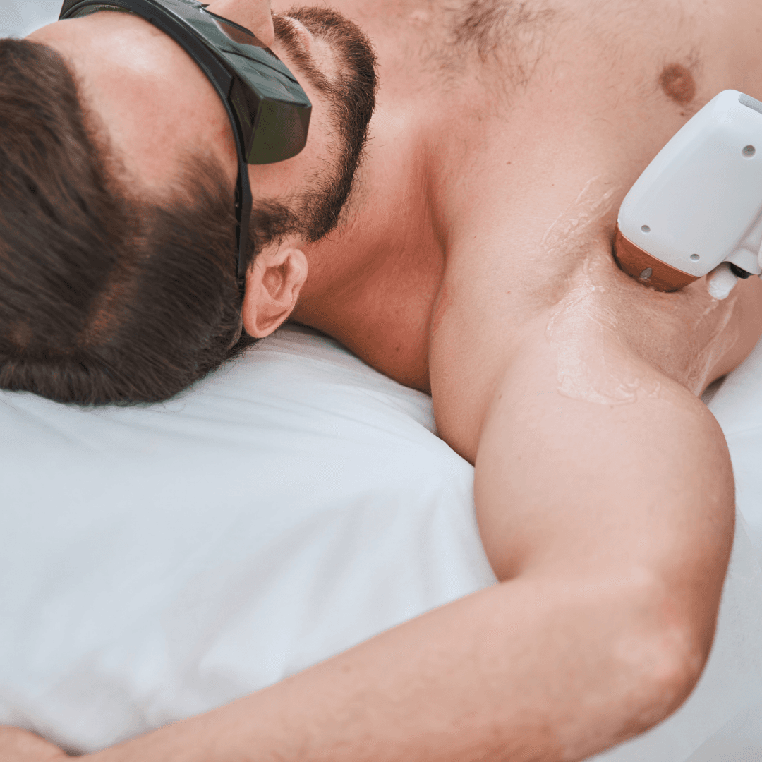 Diode Laser: Permanent Upper Body Reduction