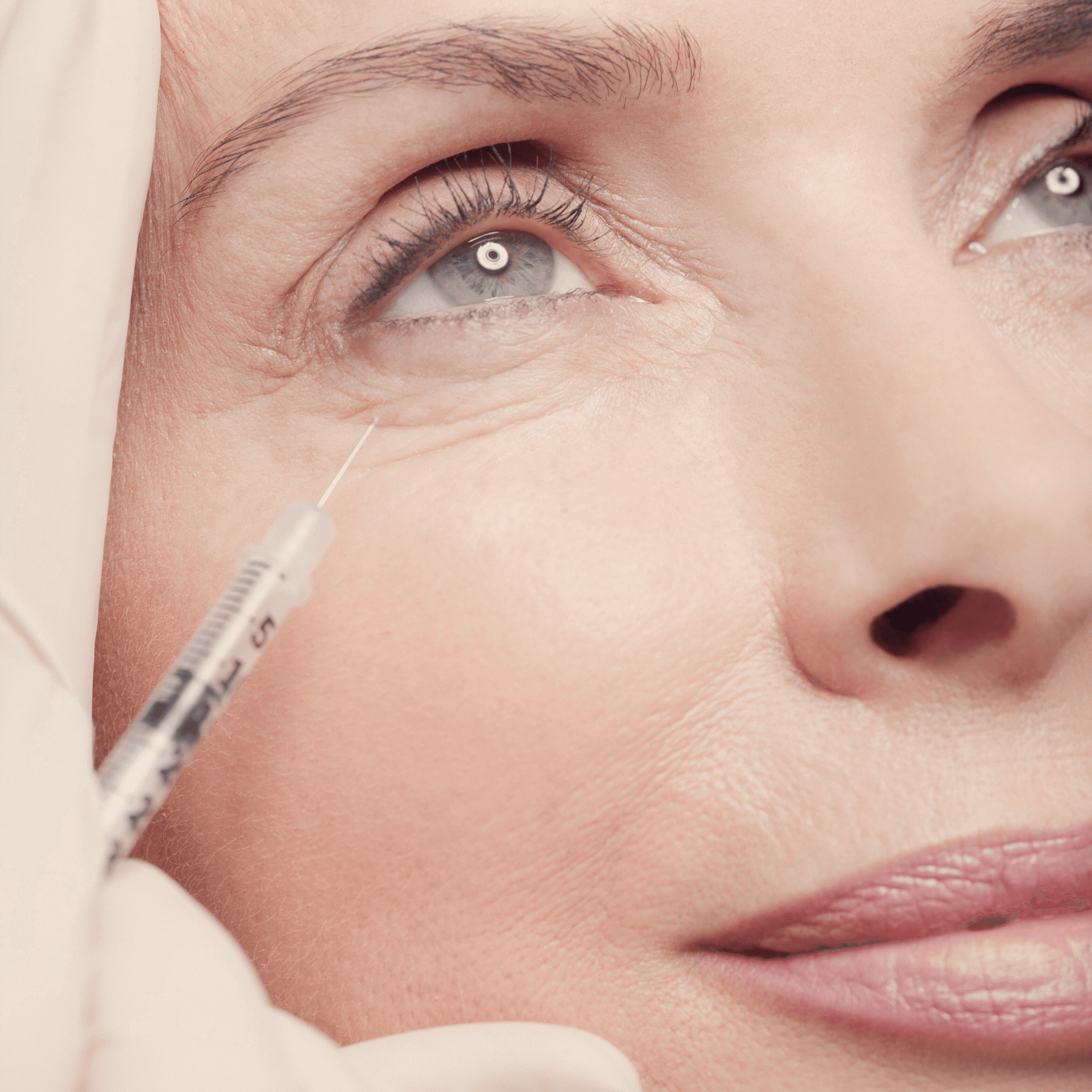 Botox for Wrinkle Reduction & Refinement