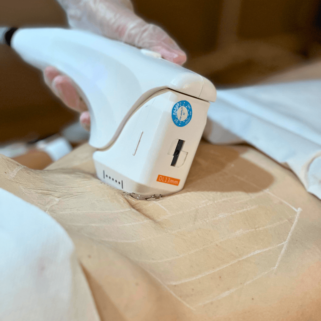 HIFU Body Skin Tightening Treatment