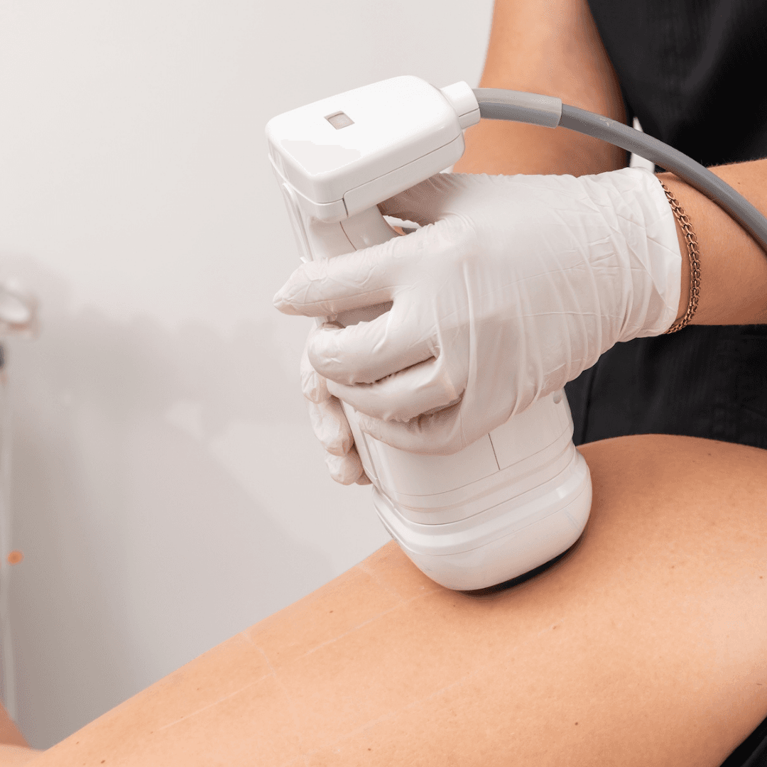 Liposonix Focused Fat Reduction