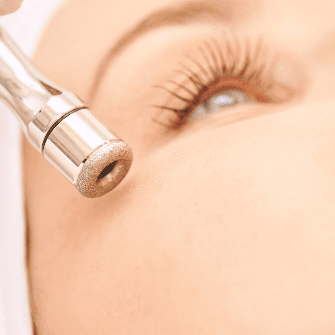 Microdermabrasion for Collagen & Scars