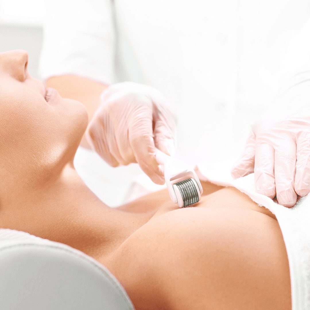 Microneedling for Scars, Wrinkles & Texture