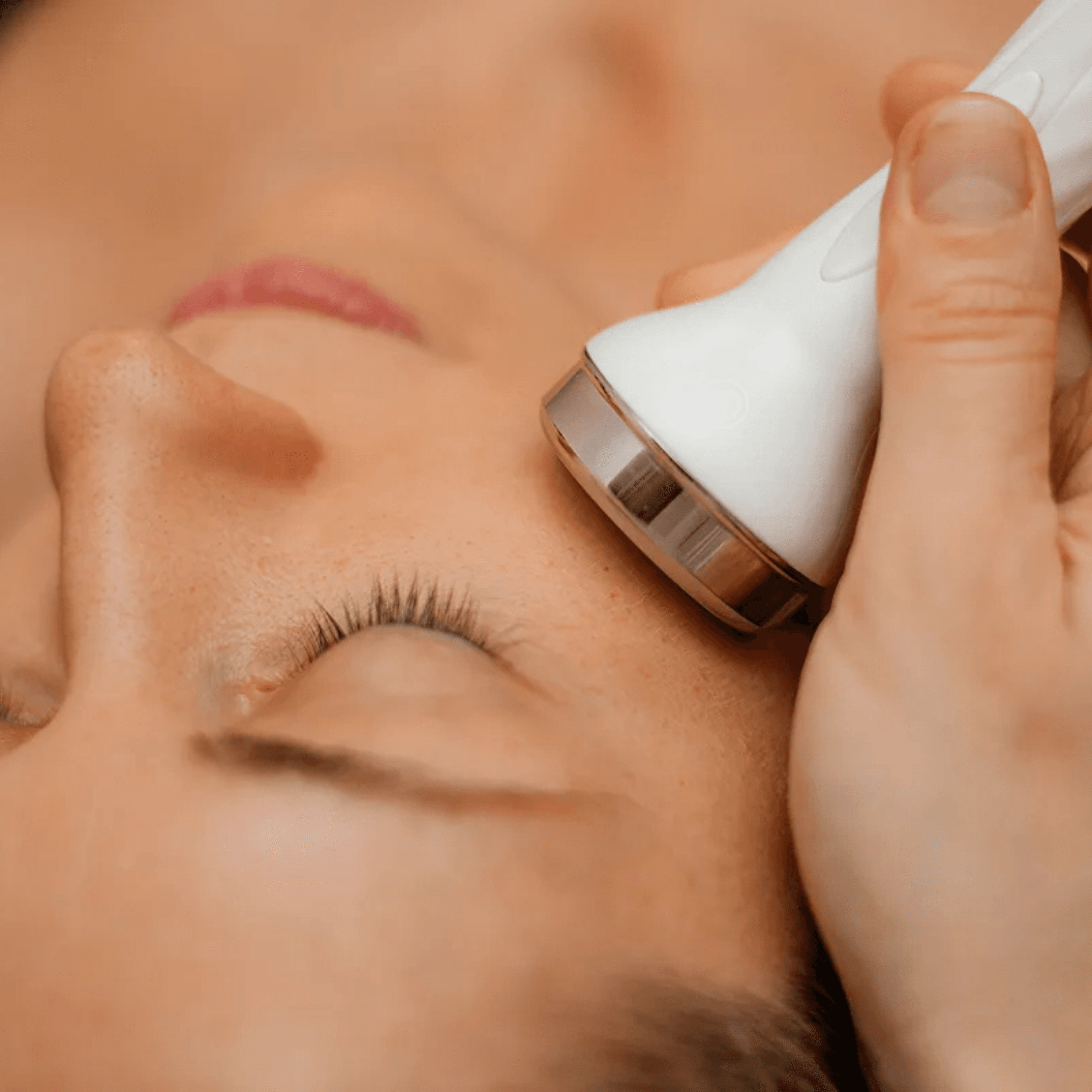 Radiance Rebuild RF Facial