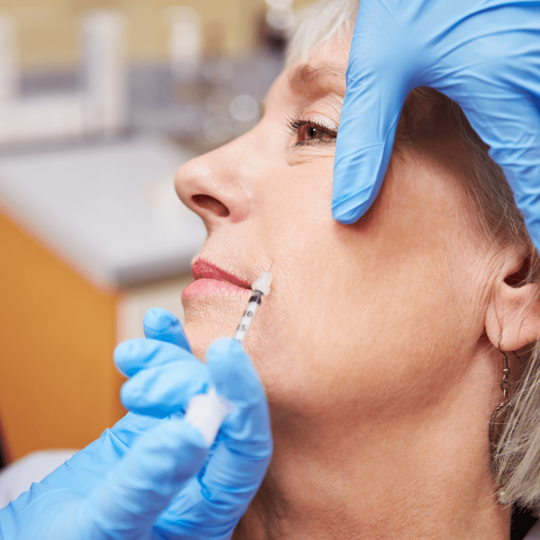 Sculptra Collagen Stimulator & Skin Tightening